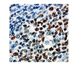 BCL-6 Monoclonal De Camundongo Clone (LN22) Pronto Para Uso - 6 Ml - Easypath - EP-12-50176